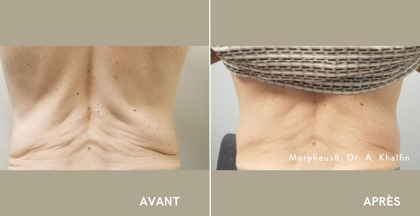 chirurgien plastique montpellier