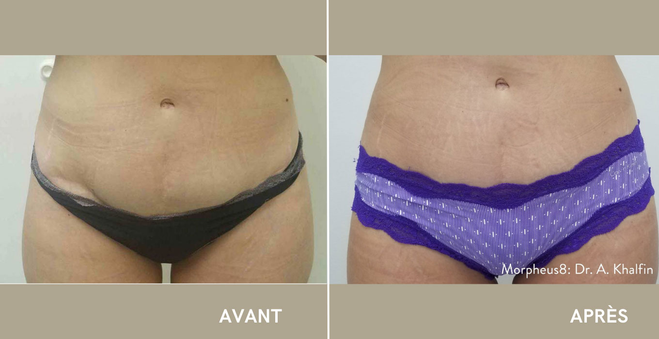 chirurgien esthetique montpellier