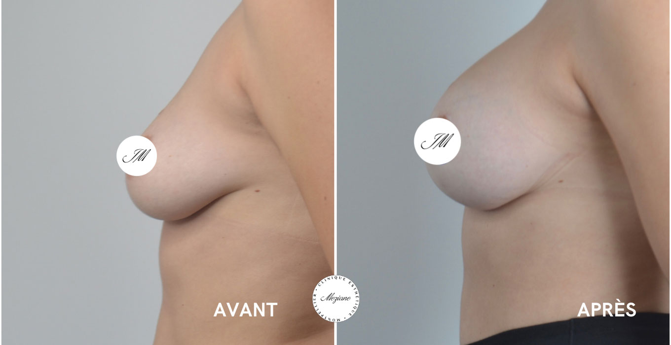 centre esthetique montpellier