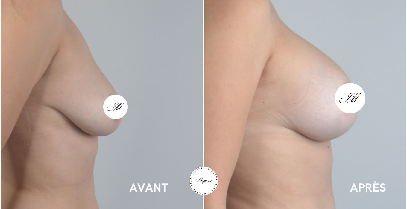 chirurgien plastique montpellier