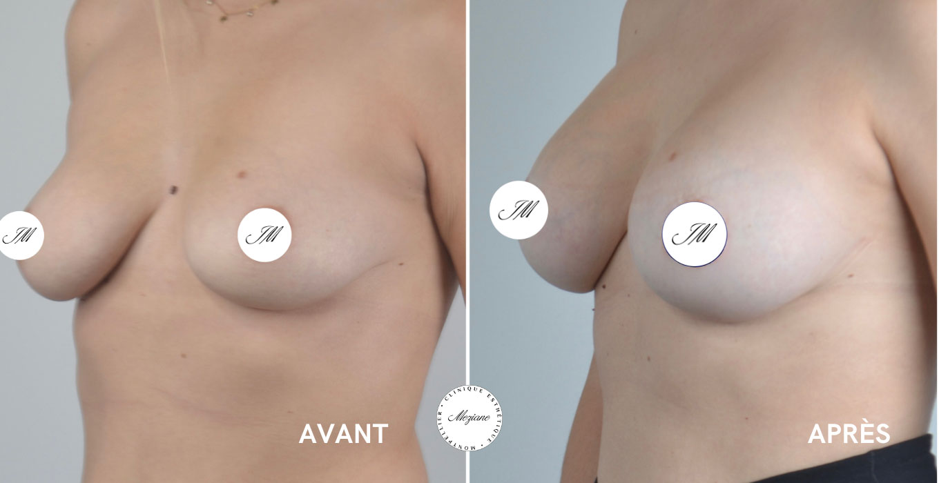 chirurgien esthetique montpellier