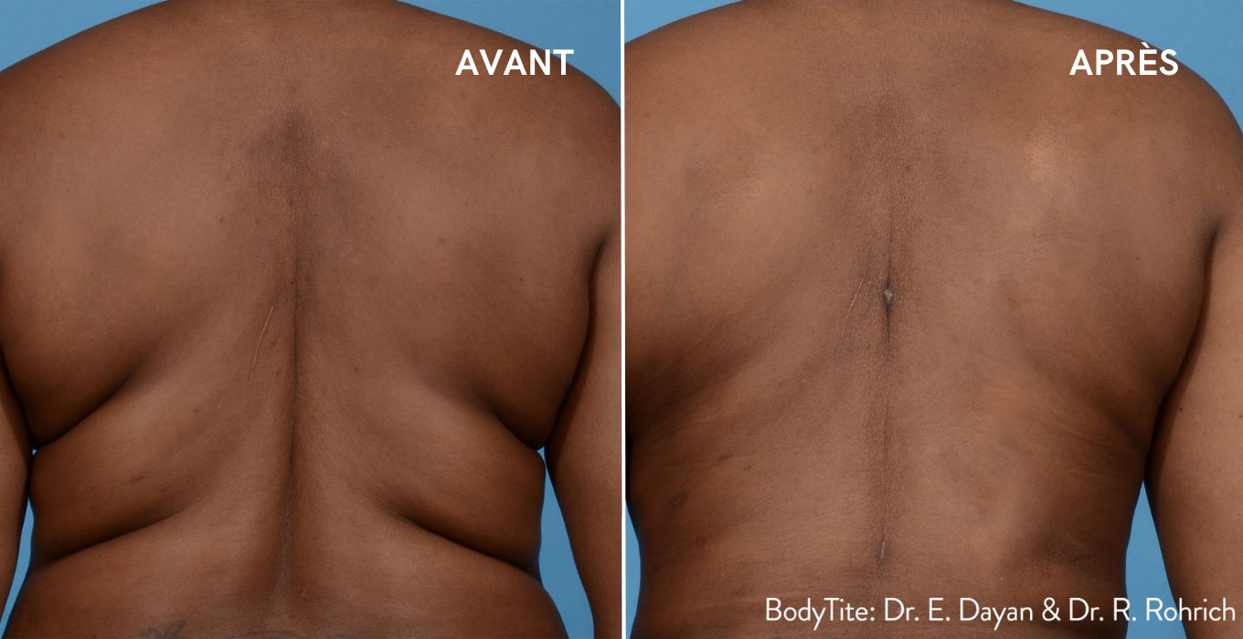 traitement esthetique visage montpellier
