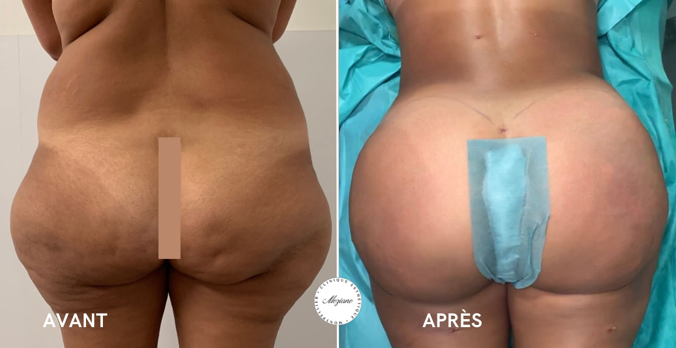 soin esthetique visage montpellier