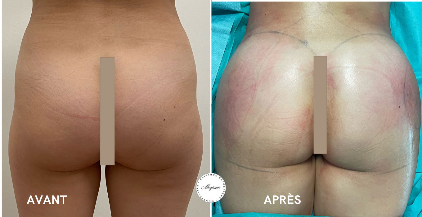 clinique chirurgie esthetique montpellier