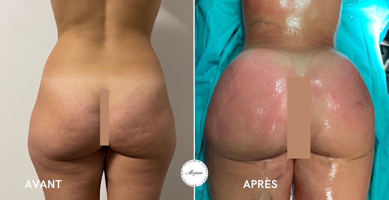 meilleur chirurgien esthetique montpellier