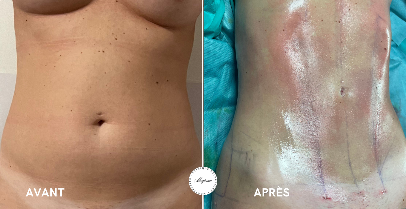 chirurgie esthetique visage montpellier