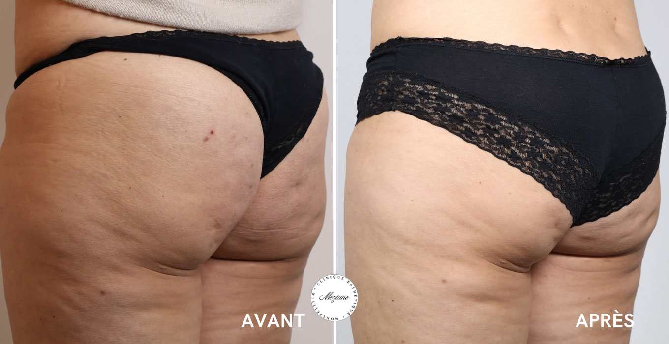 soin esthetique visage montpellier