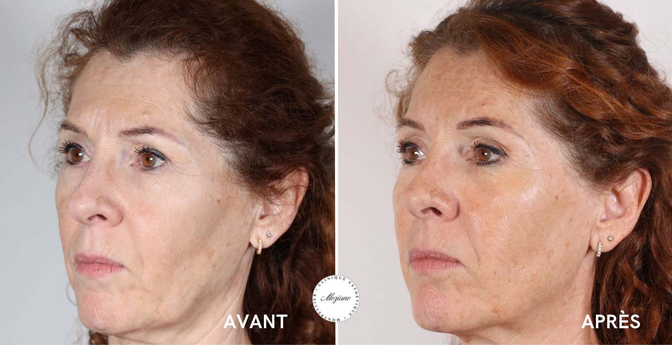 chirurgie esthetique montpellier