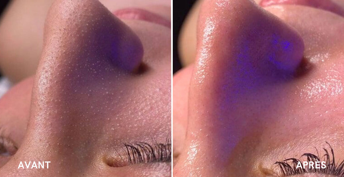 chirurgie esthetique visage a montpellier