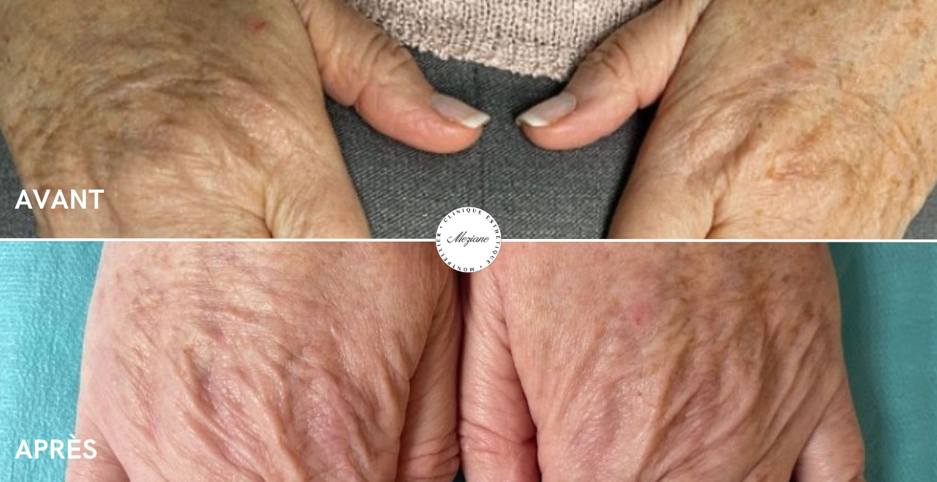 chirurgien esthetique a montpellier