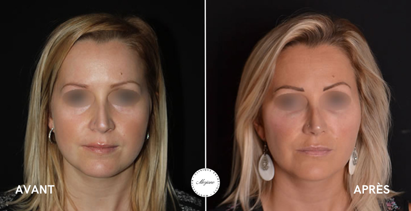chirurgien esthetique a montpellier
