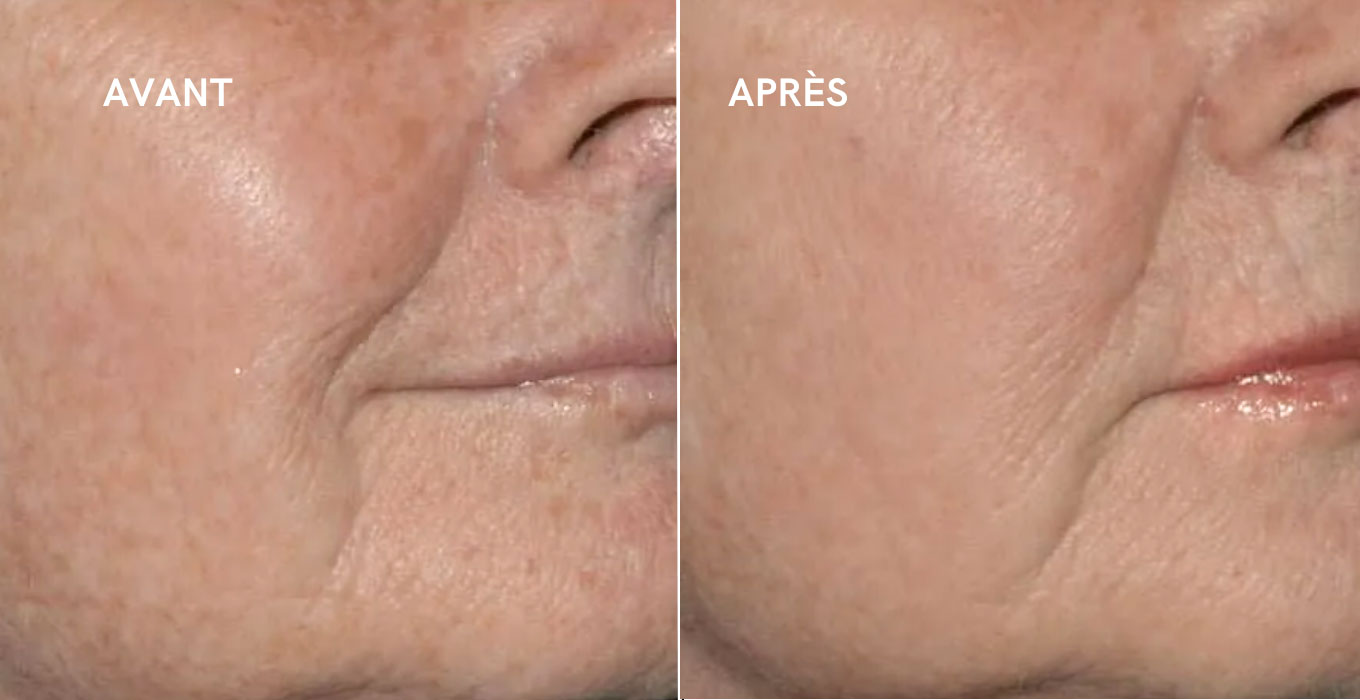 chirurgie esthetique visage montpellier
