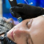 rhinoplastie montpellier