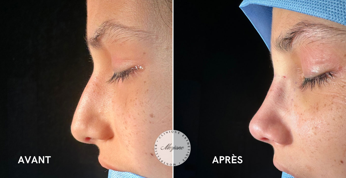 meilleur chirurgien esthetique montpellier