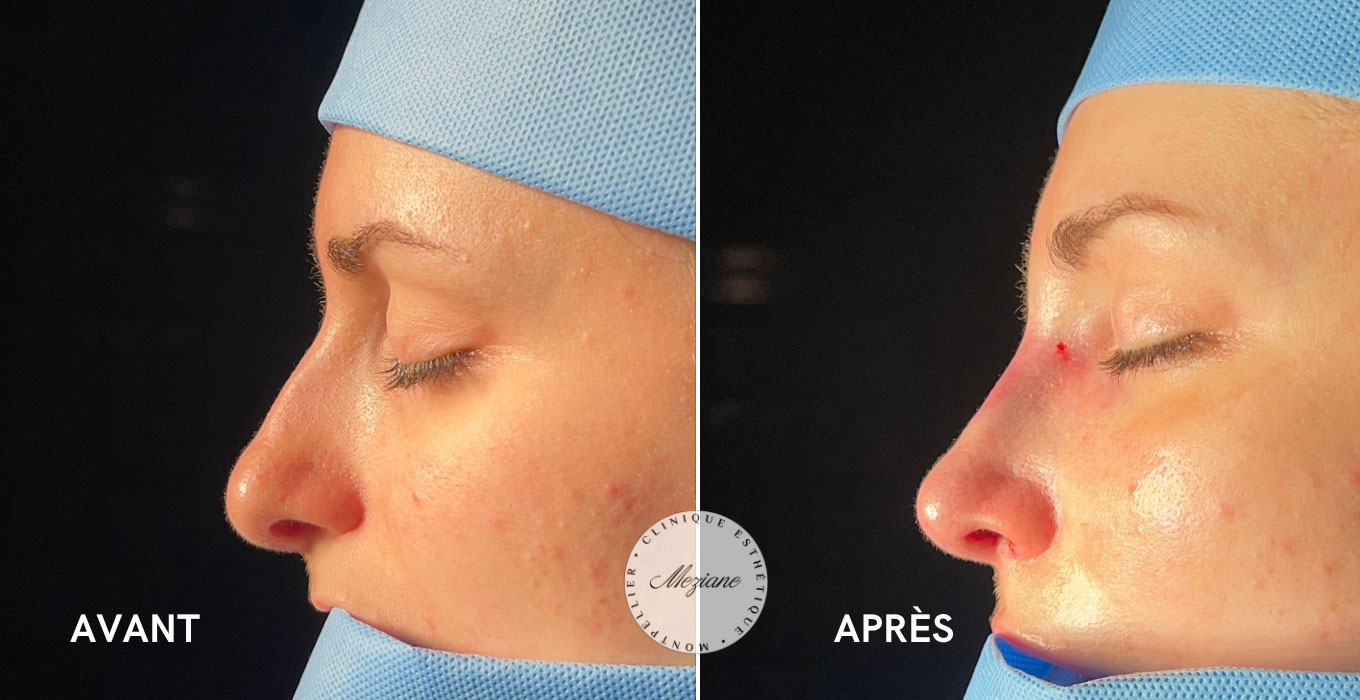 clinique chirurgie esthetique montpellier