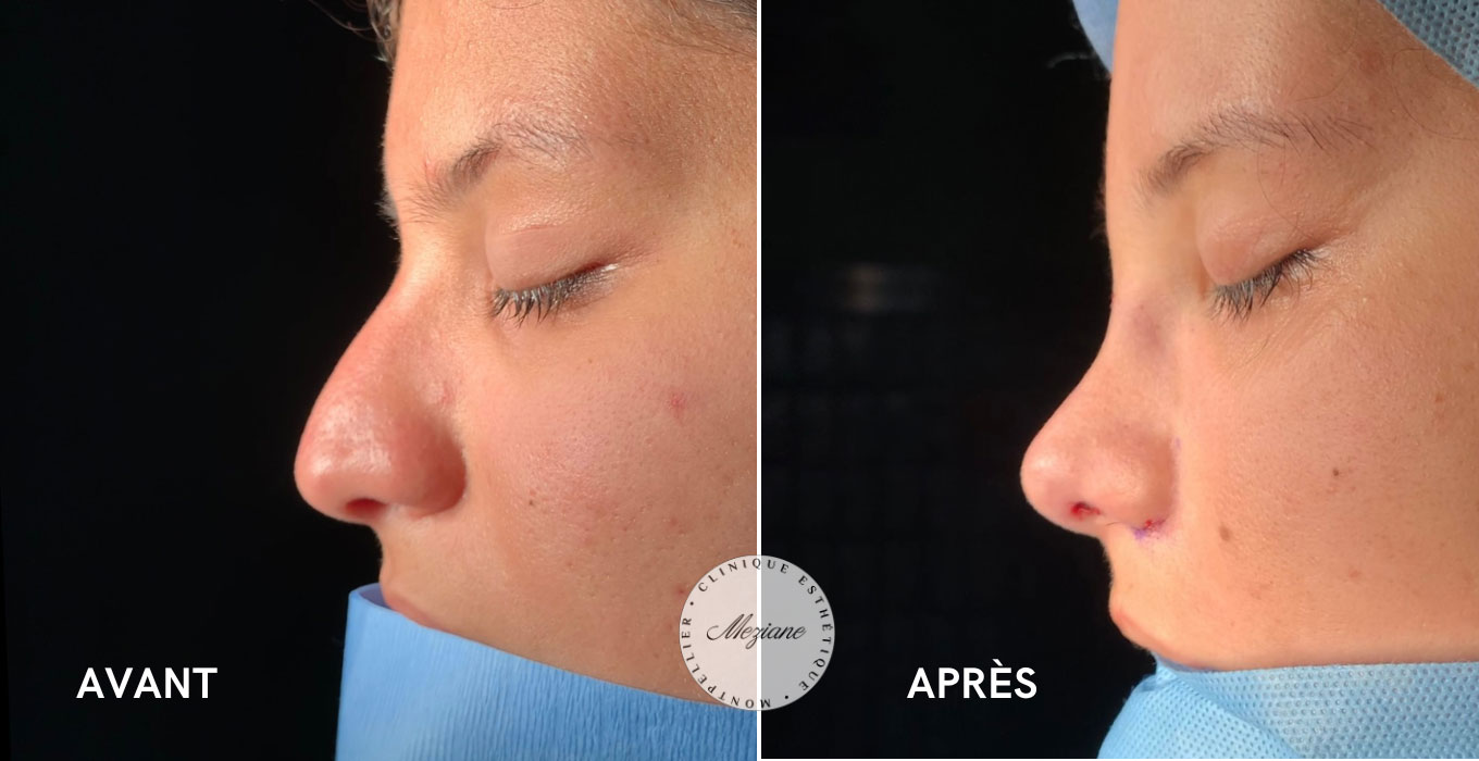 traitement esthetique visage montpellier