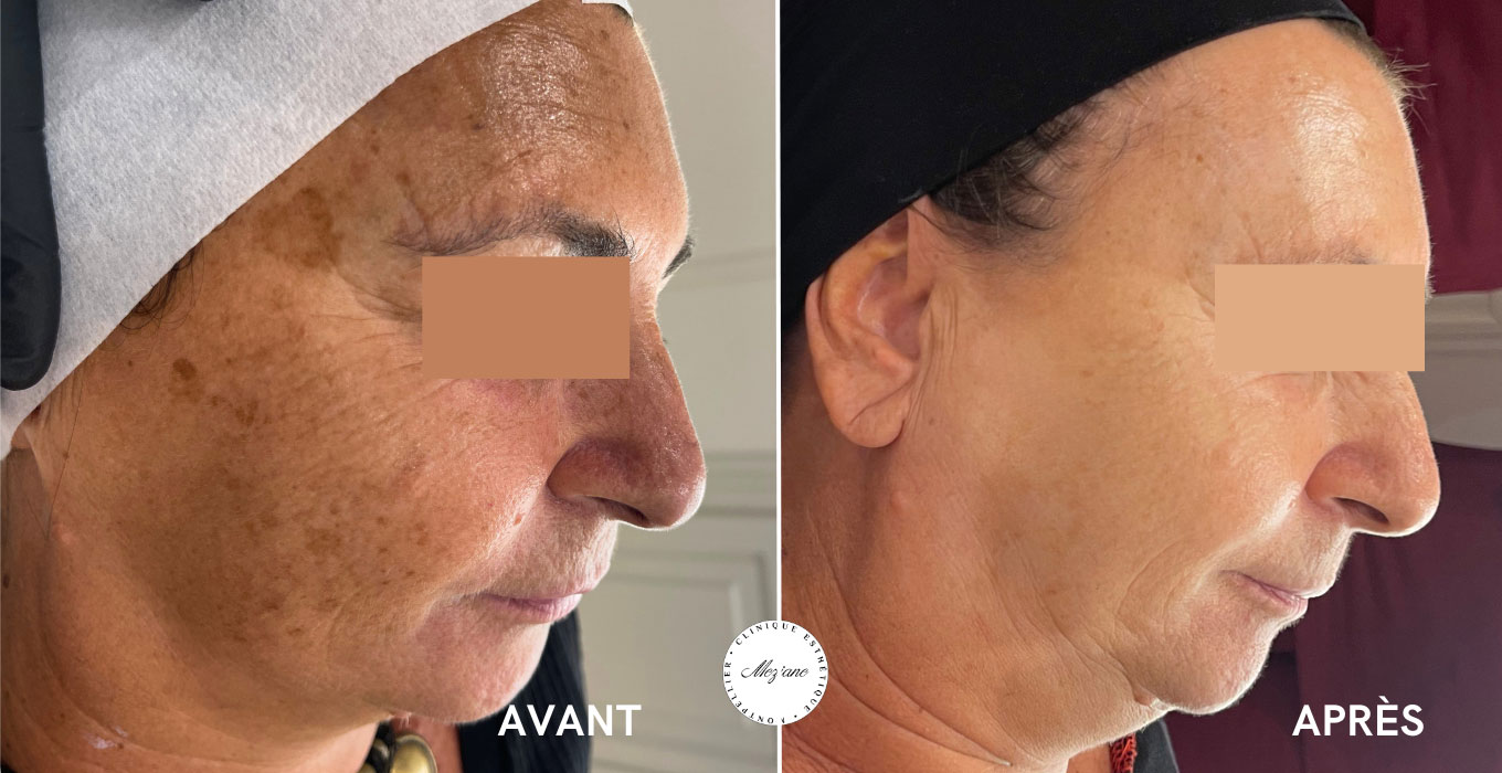 chirurgie esthetique a montpellier