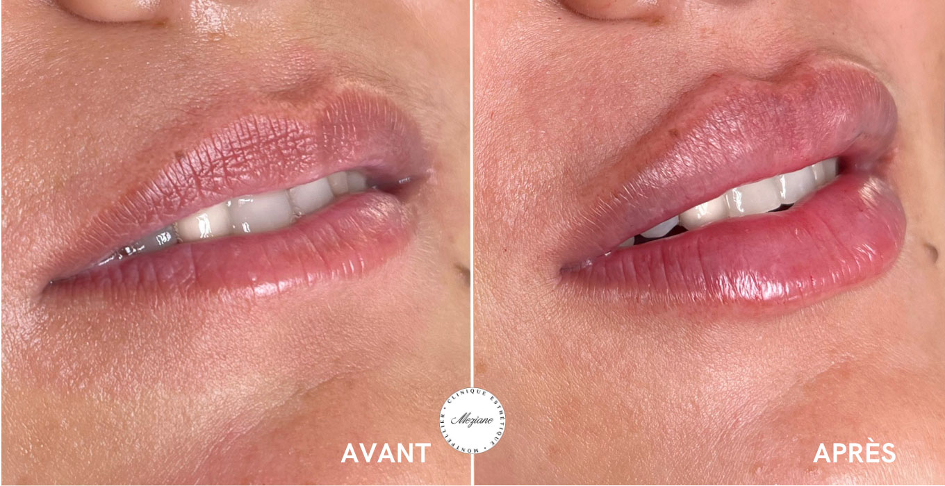 centre esthetique a montpellier