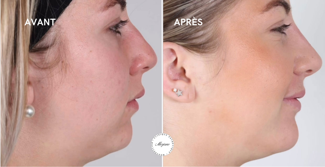 clinique esthetique a montpellier