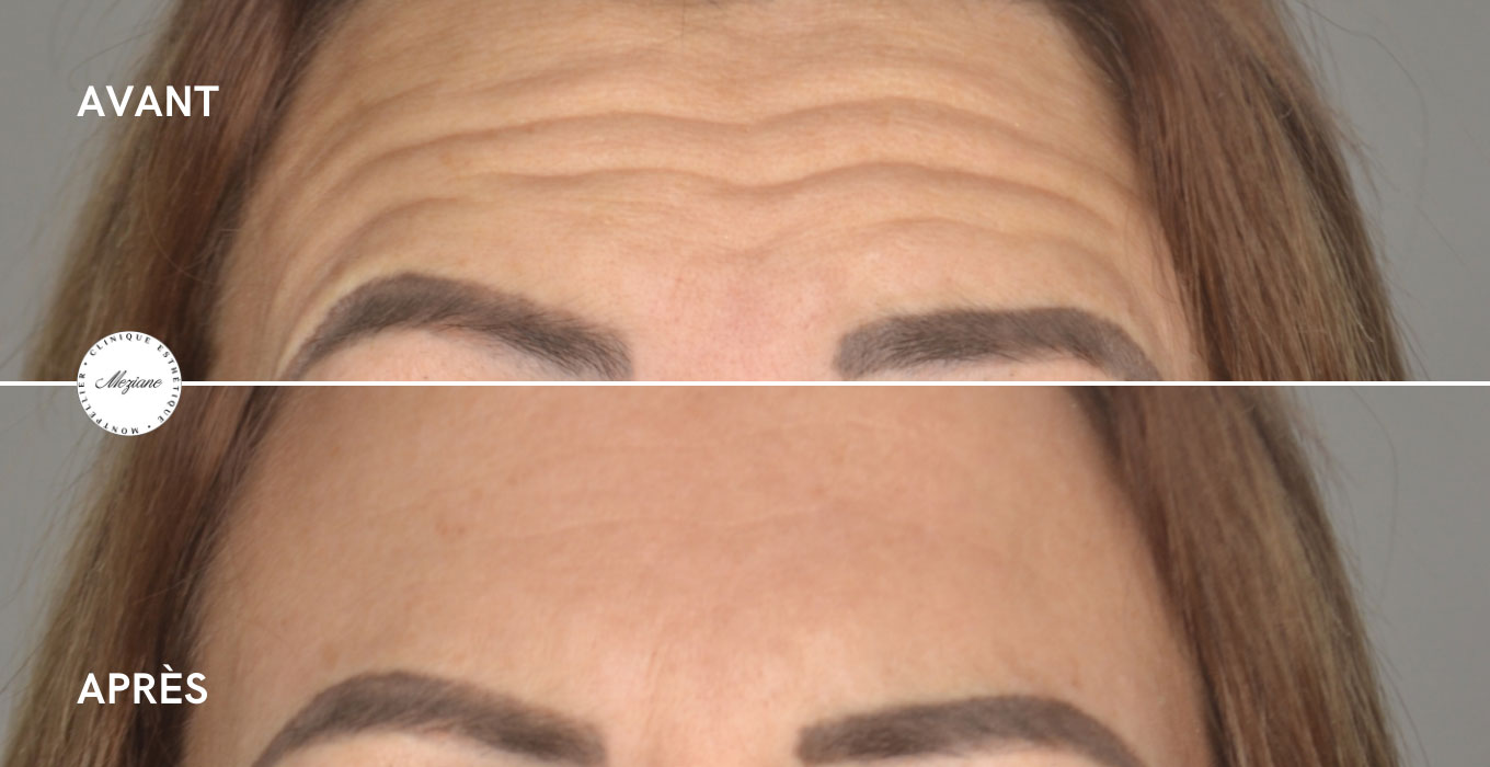 chirurgie esthetique a montpellier