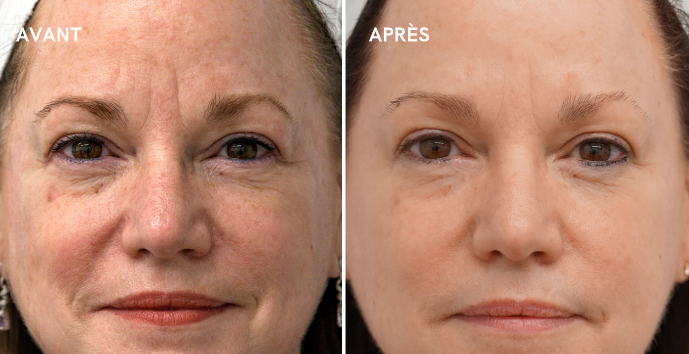 clinique esthetique a montpellier