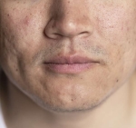 chirurgie esthetique visage montpellier