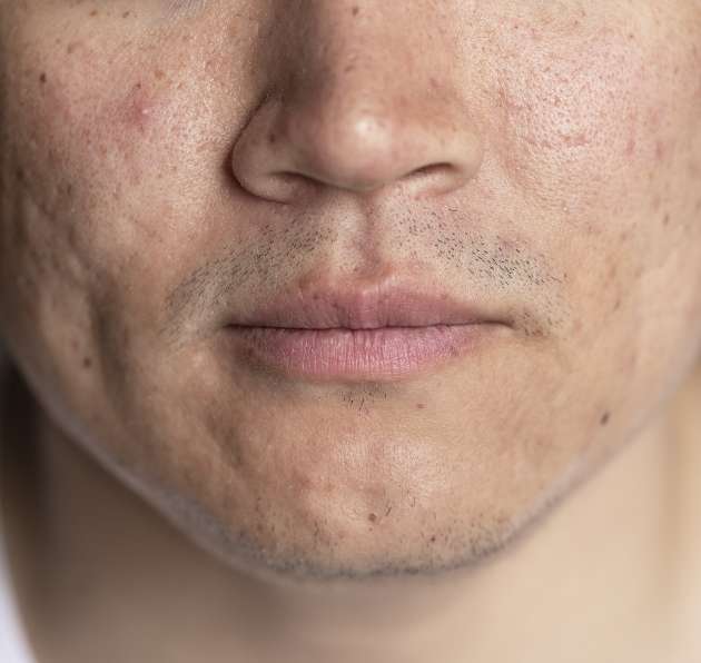 chirurgie esthetique visage montpellier