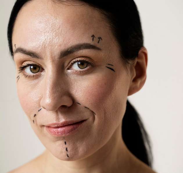 chirurgie esthetique a montpellier