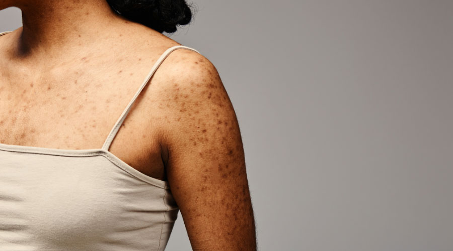 clinique chirurgie esthetique a montpellier