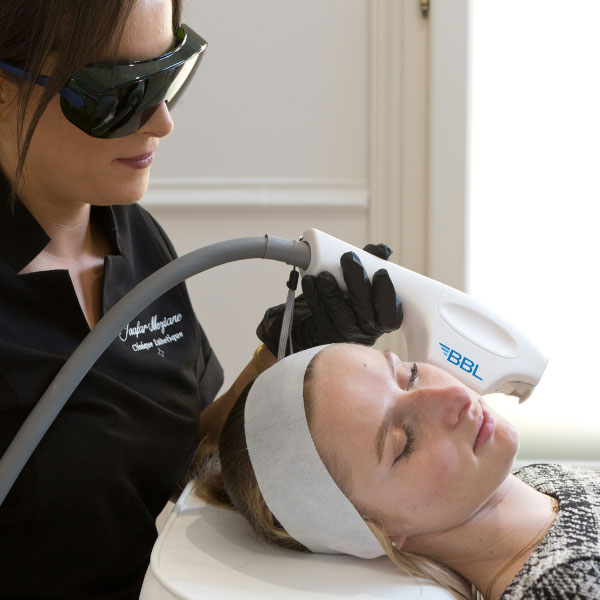 epilation definitive a montpellier