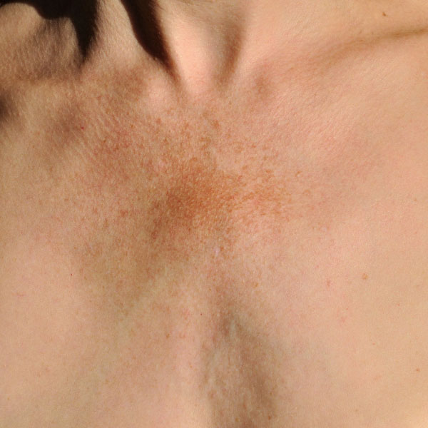 chirurgie esthetique visage a montpellier