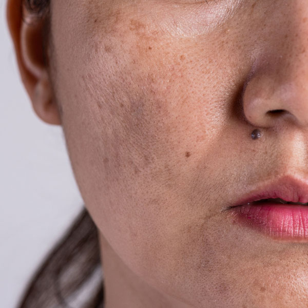 soin esthetique visage a montpellier