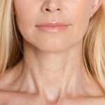 chirurgie esthetique a montpellier