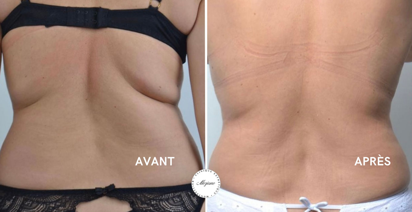 chirurgien plastique montpellier