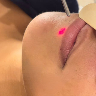 chirurgien esthetique montpellier