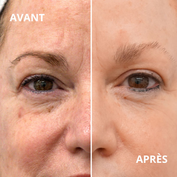 clinique esthetique montpellier