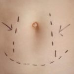 chirurgie esthetique montpellier