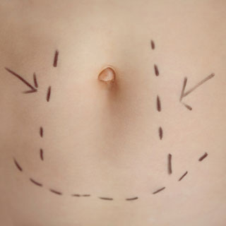 chirurgie esthetique montpellier