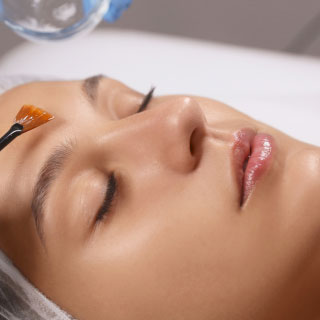 injection acide hyaluronique montpellier