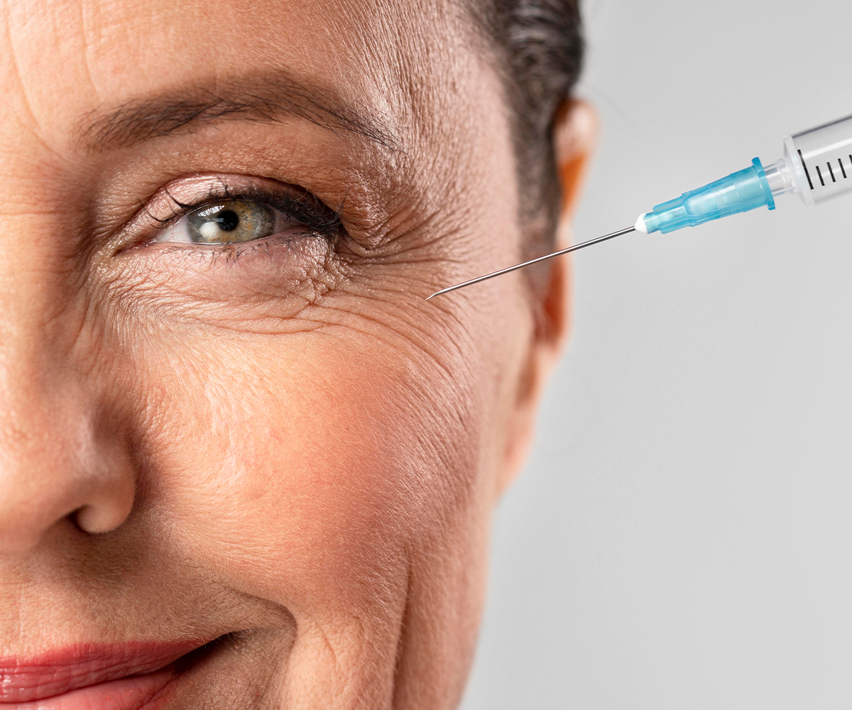 injection de botox montpellier