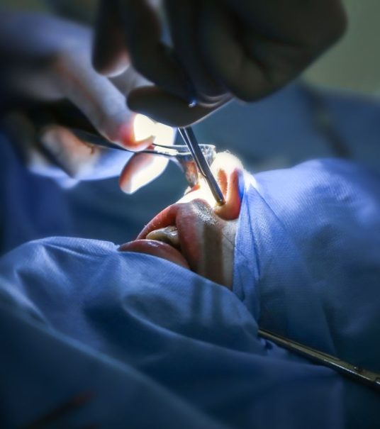 rhinoplastie montpellier dr jaafar meziane
