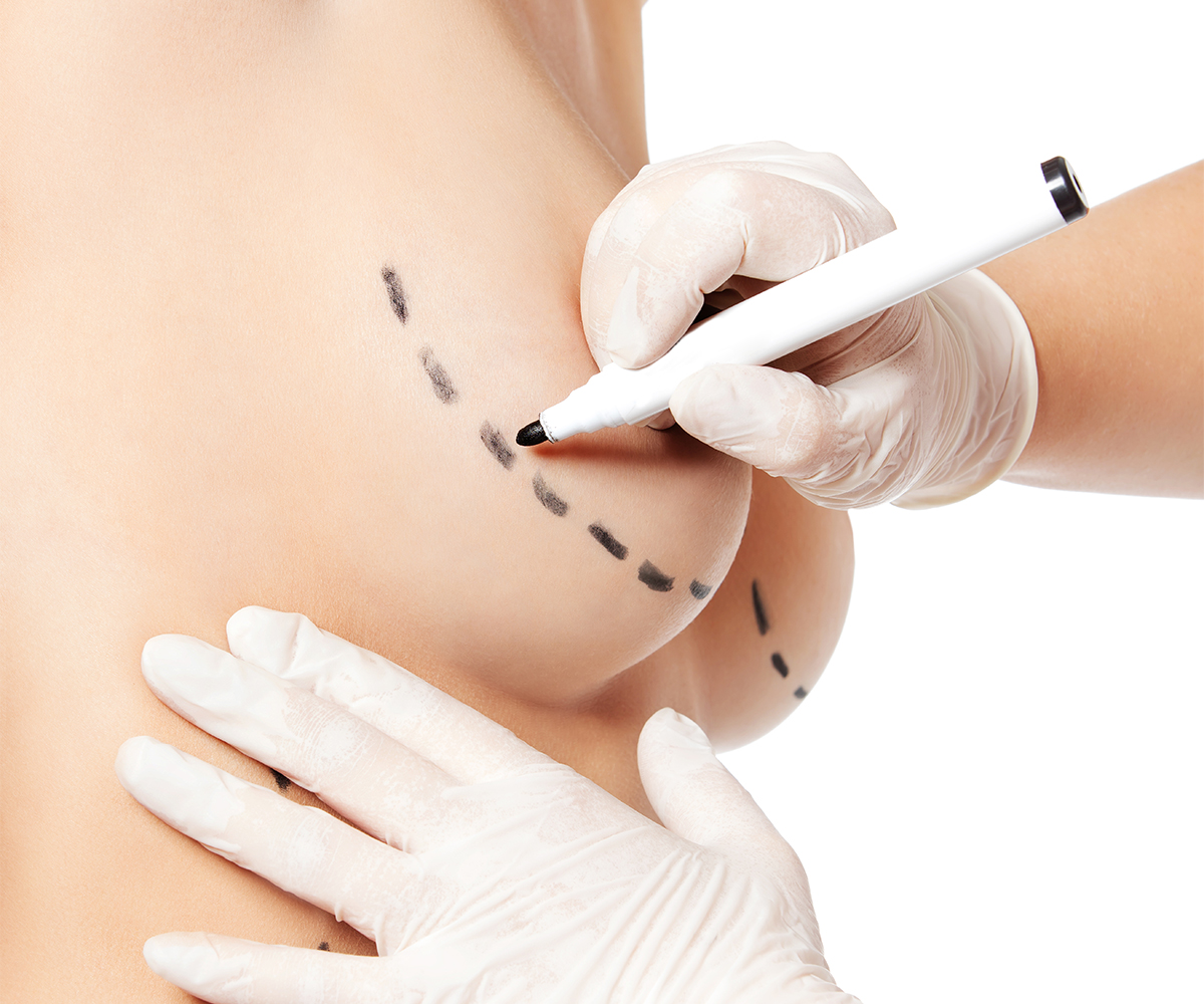 lifting mammaire montpellier