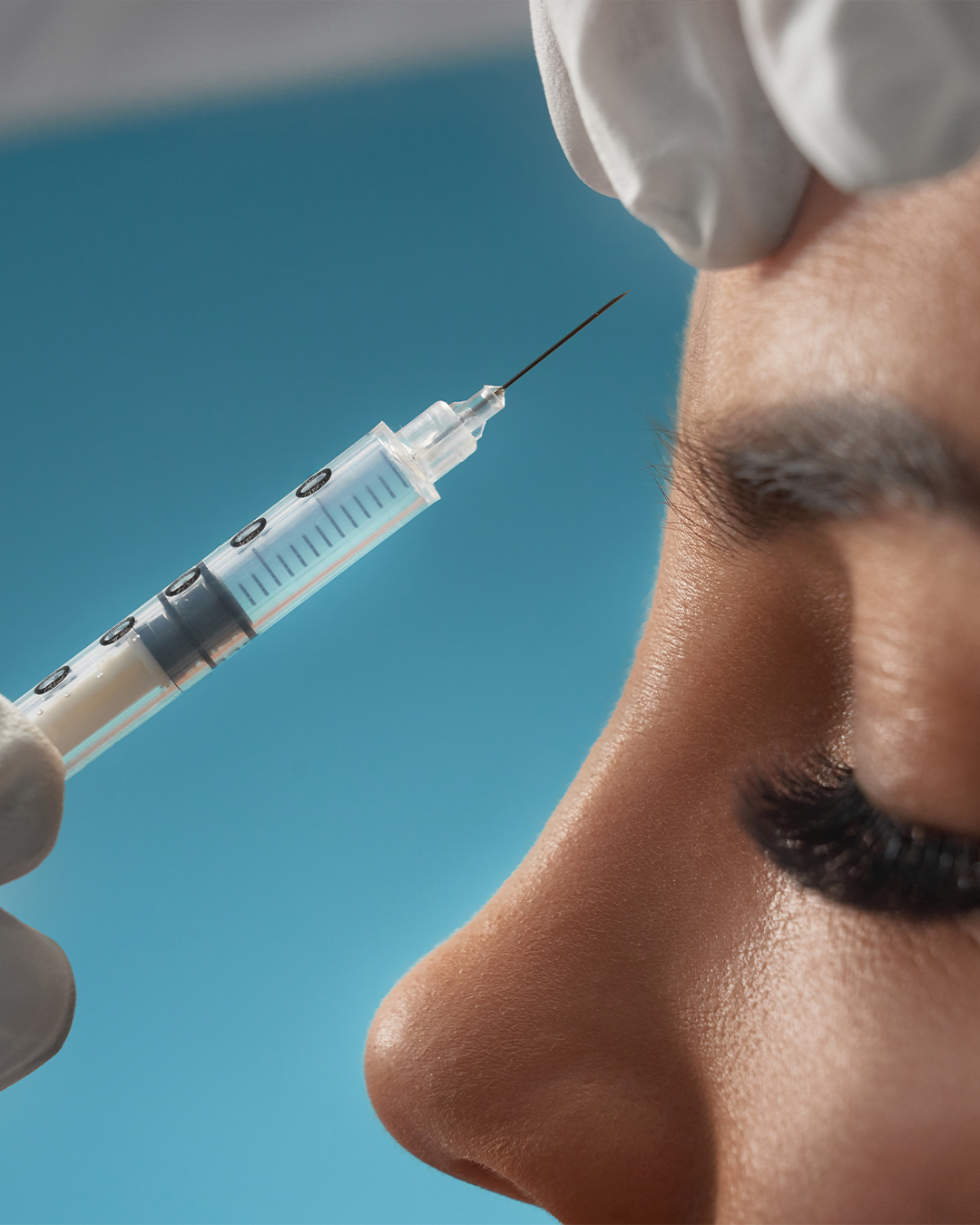 injection de botox a montpellier