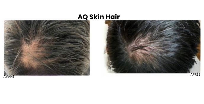 Aq Skin Hair